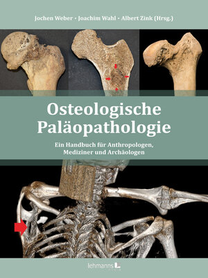 cover image of Osteologische Paläopathologie